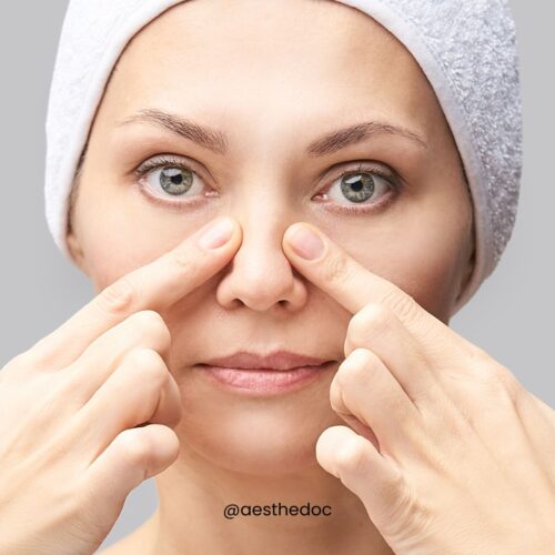 Rhinoplasty | Nose Lift Surgery | Islamabad Rawalpindi | Pakistan