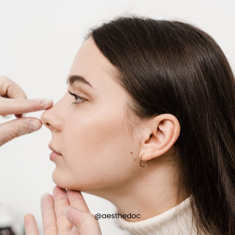 Nose Lift | Nose Reshaping | Nose Augmentation