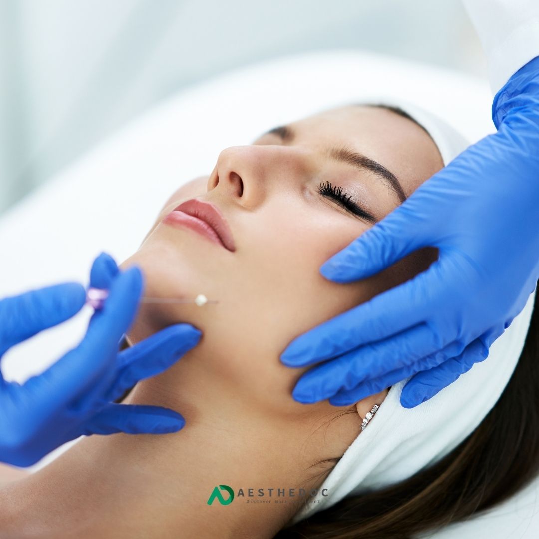 Full Face Thread Lift Treatment