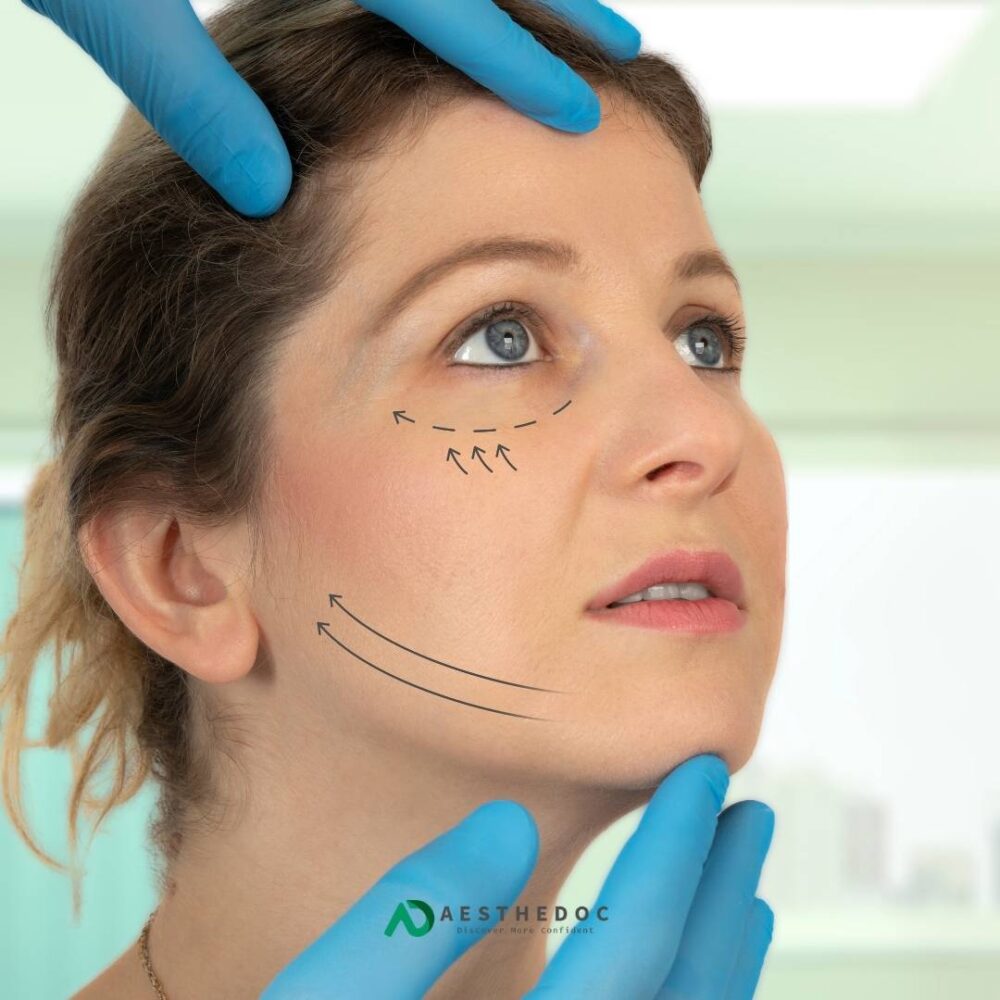Undereye Area Threads in Islamabad
