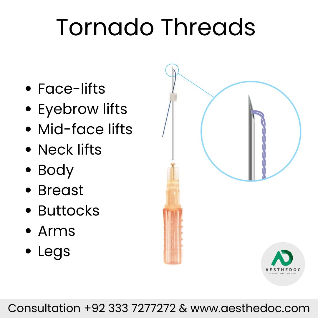 Tornado Threads for Face Lift