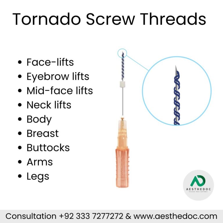 Tornado Screw Threads