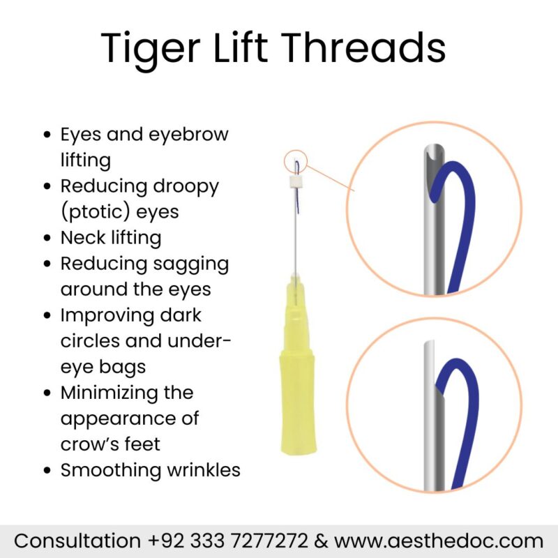 Eyebrow Lift Threads | Tiger Cat Eye Lift | Islamabad Rawalpindi Pakistan