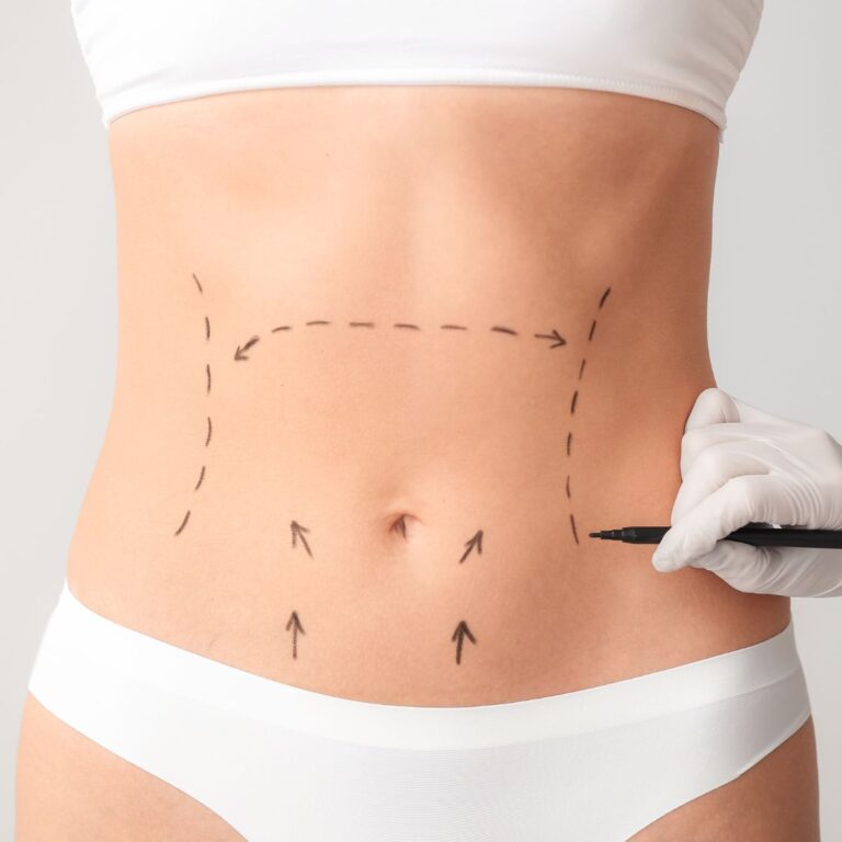 Body Sculpting Islamabad