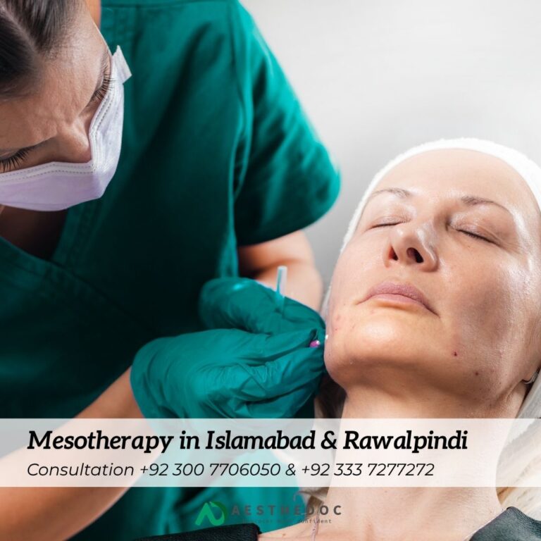Mesotherapy in Islamabad & Rawalpindi