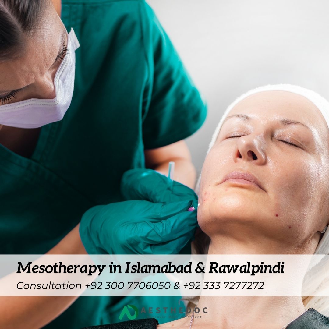 Mesotherapy in Islamabad & Rawalpindi