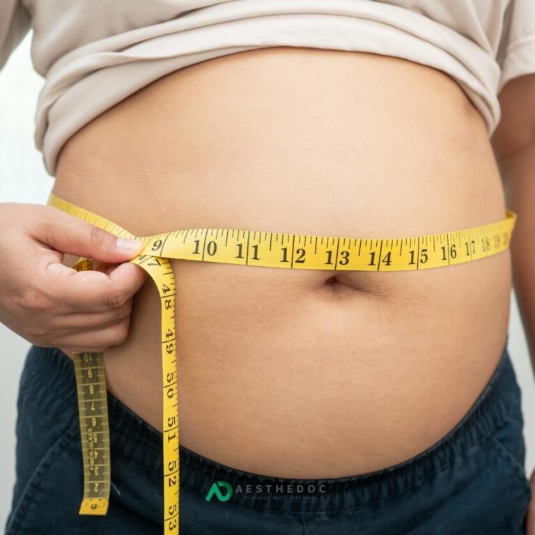 Fat Cellulite & Fat Dissolving Injections Treatment in Islamabad | Aesthedoc Clinic