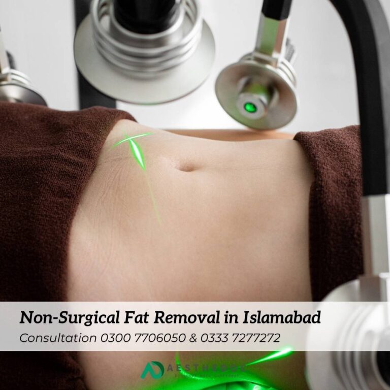 Non-Surgical Fat Removal in Islamabad