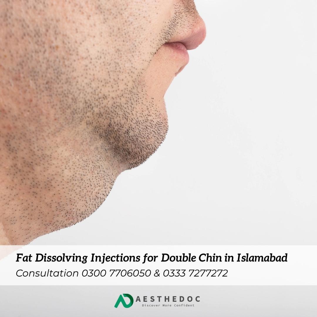 Fat Dissolving Injections for Double Chin in Islamabad