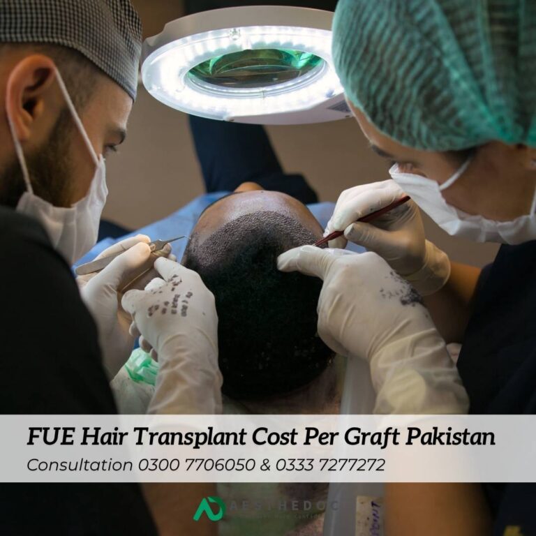 FUE Hair Transplant Cost Per Graft in Pakistan
