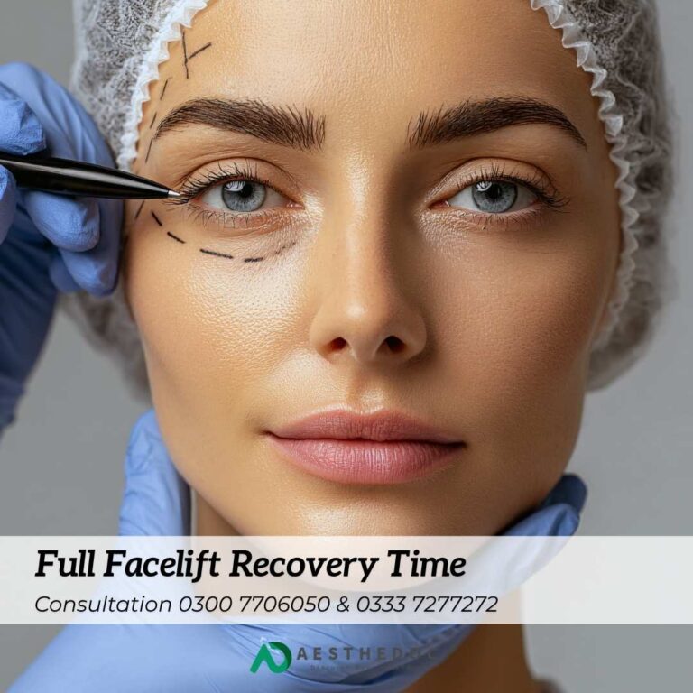 Full Facelift Recovery Time
