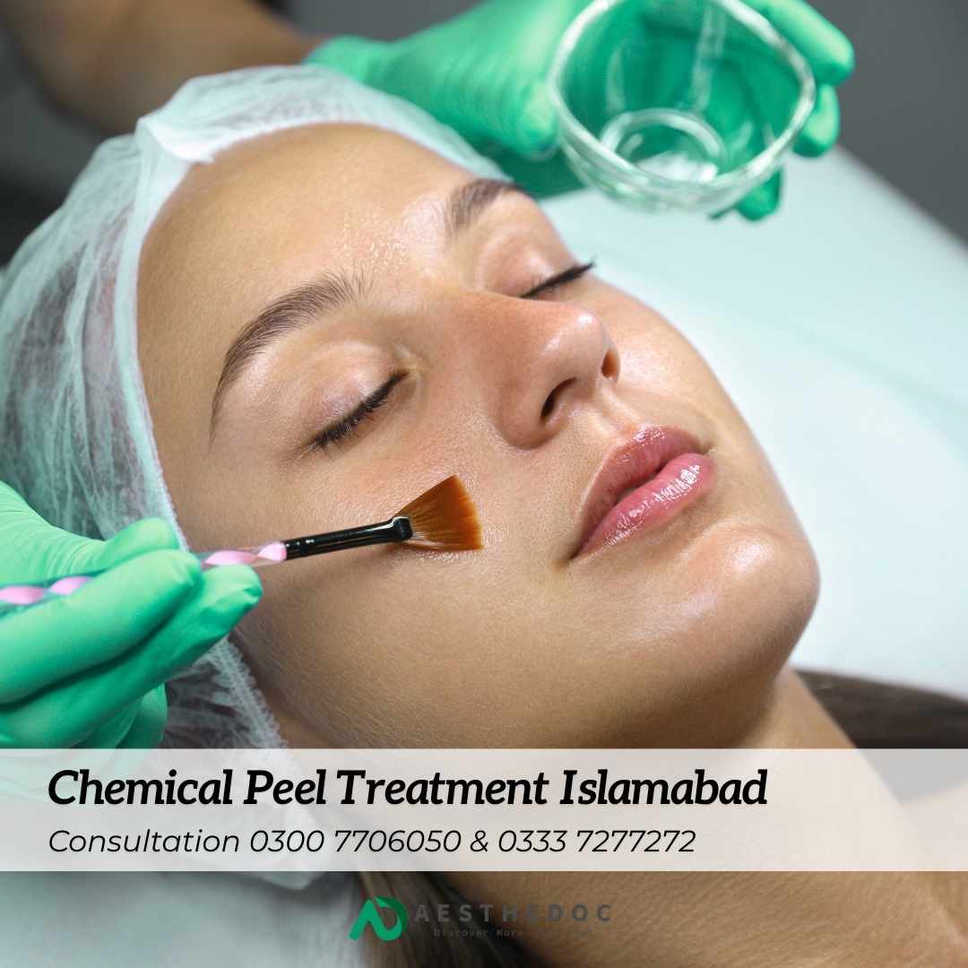 Chemical Peel Treatment in Islamabad