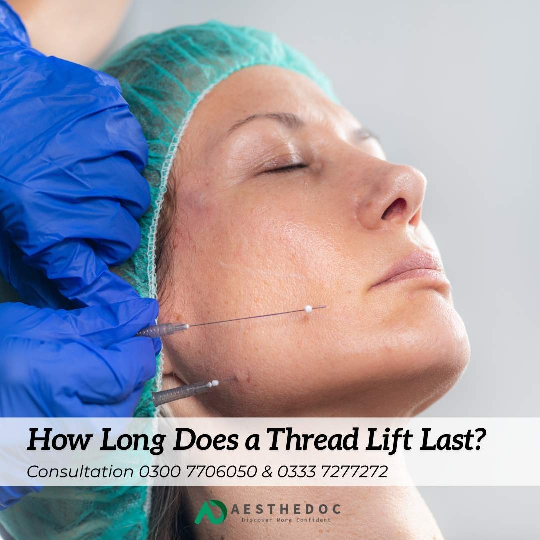 How Long Does a Thread Lift Last