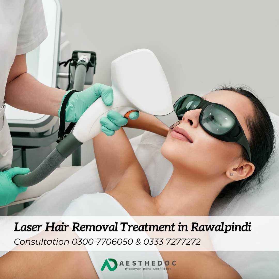 Laser Hair Removal Treatment in Rawalpindi