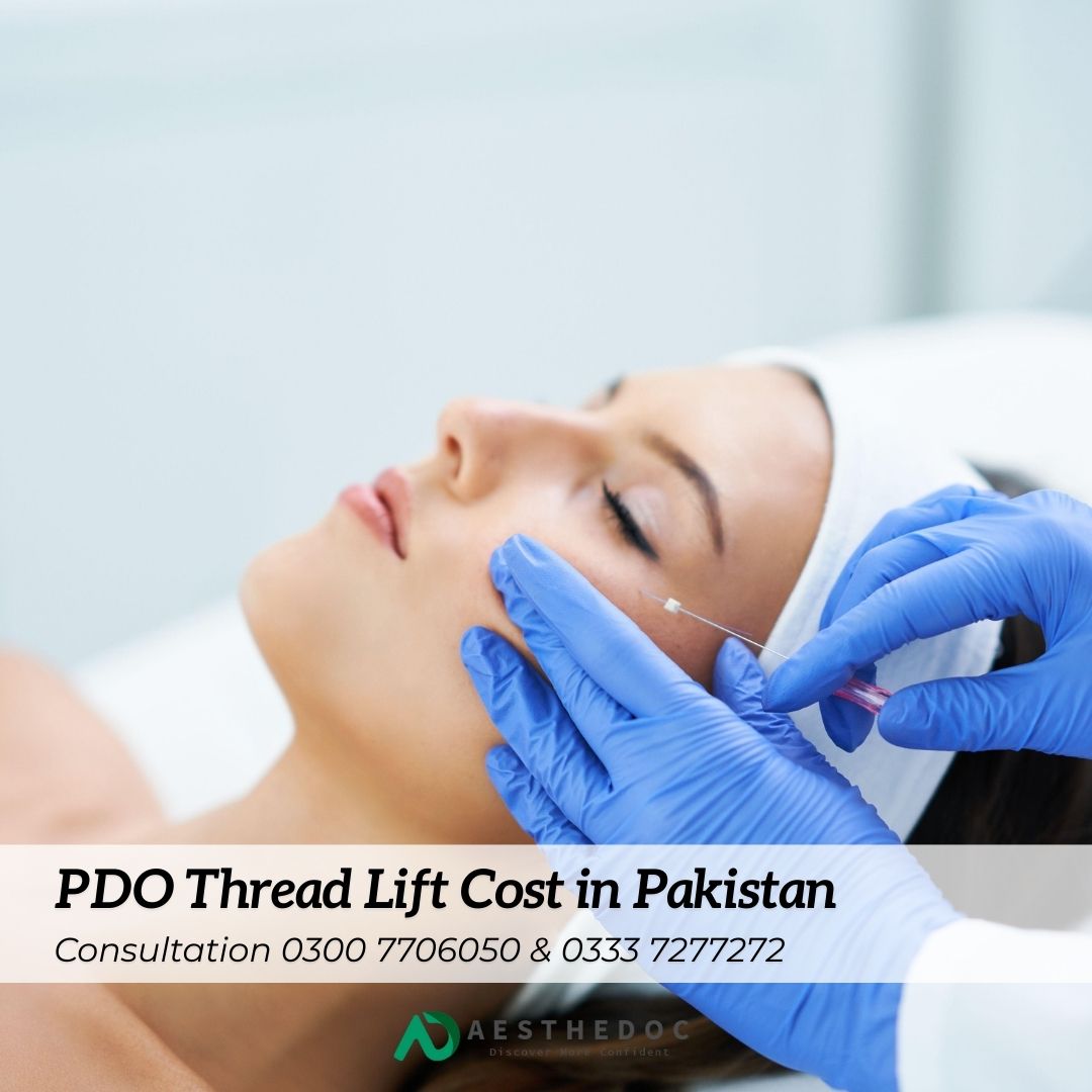 PDO Thread Lift Cost in Pakistan