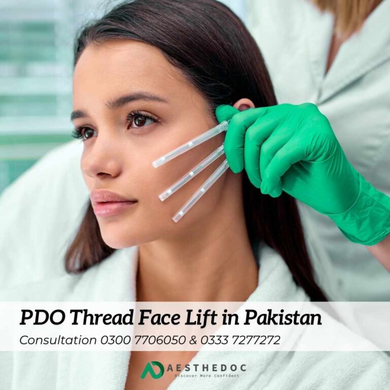 PDO Thread Face Lift in Pakistan