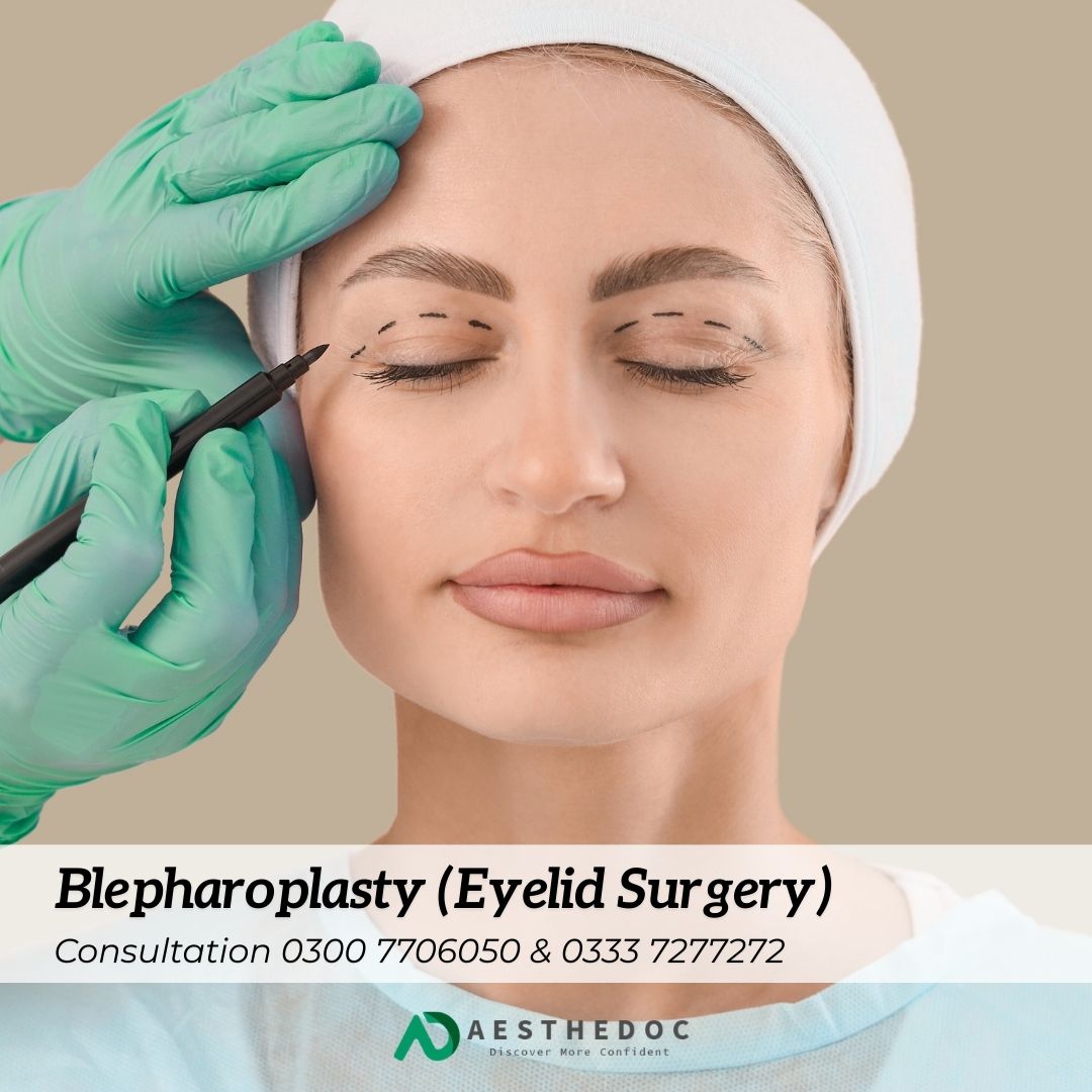 Blepharoplasty (Eyelid Surgery) in Islamabad Rawalpindi Pakistan