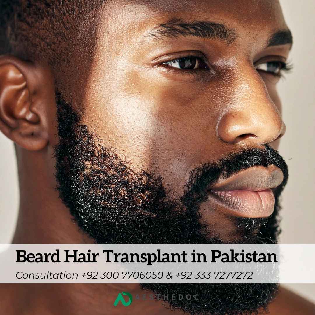 Beard Hair Transplant in Pakistan