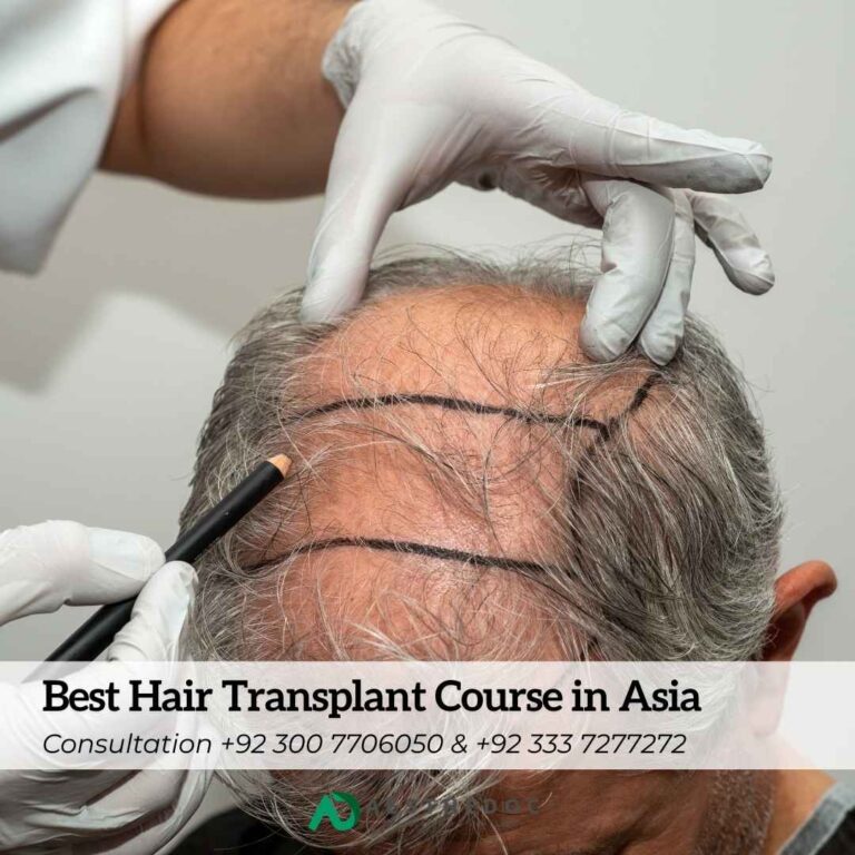 Best Hair Transplant Course in Asia
