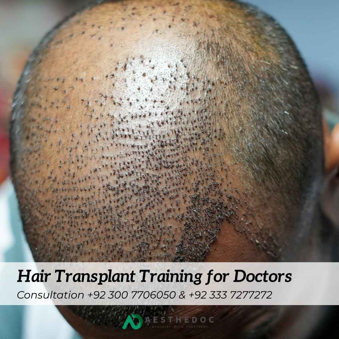 Hair Transplant Training for Doctors World Best Hair Transplant Institute