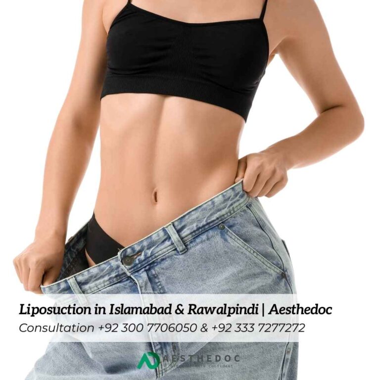 Liposuction in Islamabad & Rawalpindi