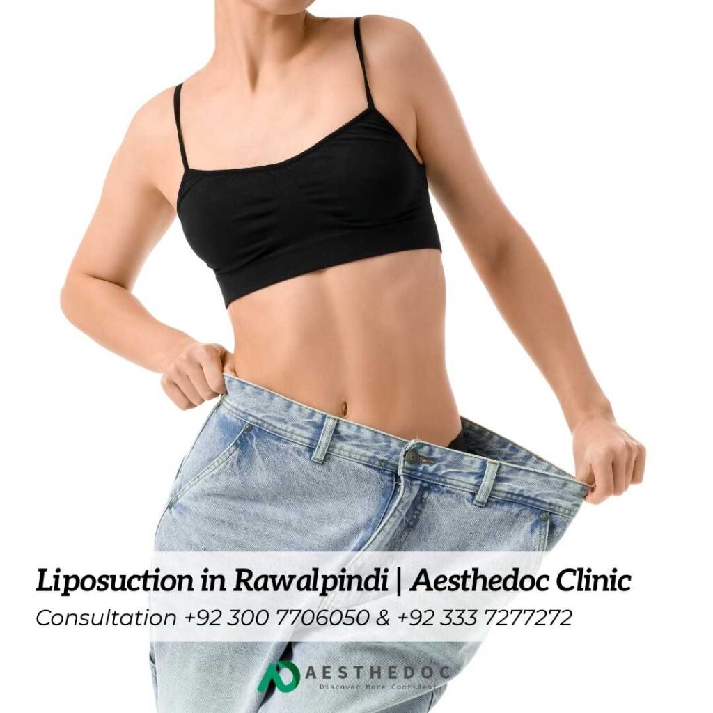 Liposuction in Rawalpindi | Aesthedoc Clinic