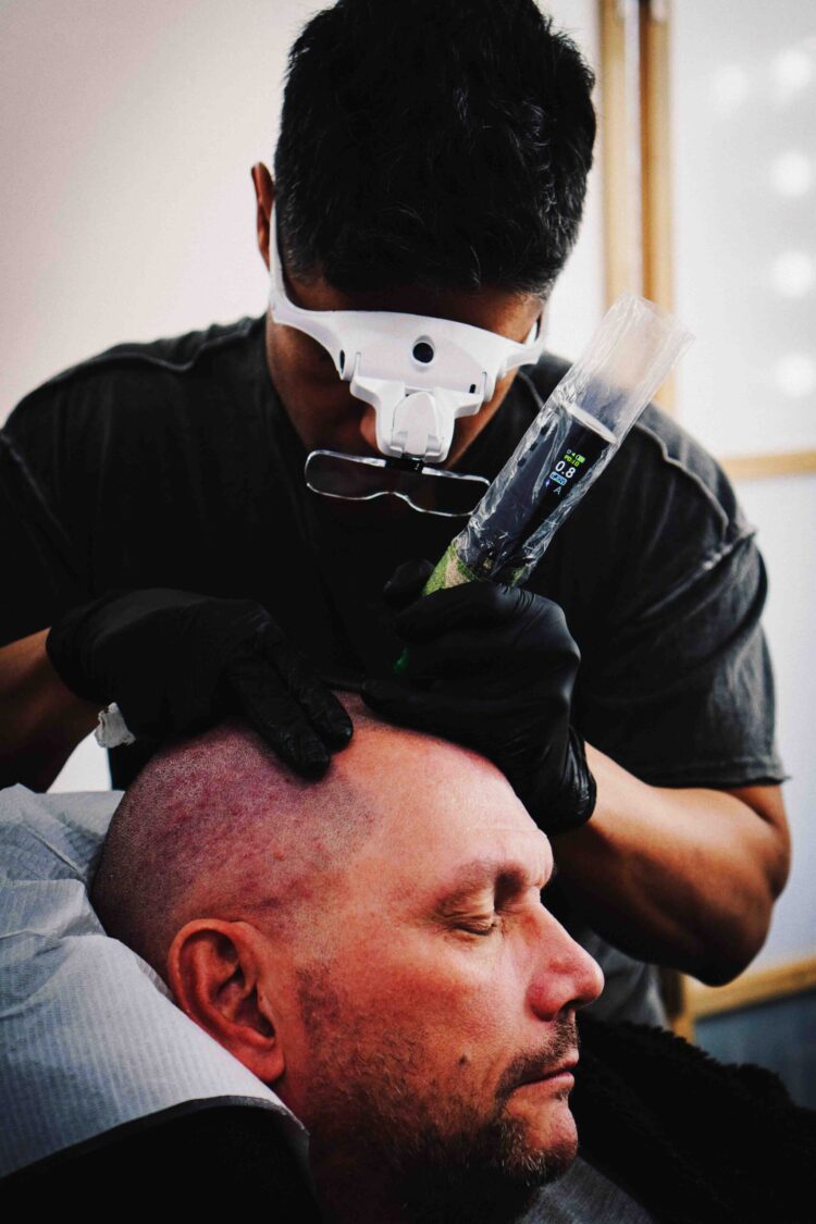 Online vs Hands-On Hair Transplant Training