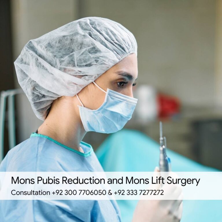 Mons Pubis Reduction and Mons Lift Surgery