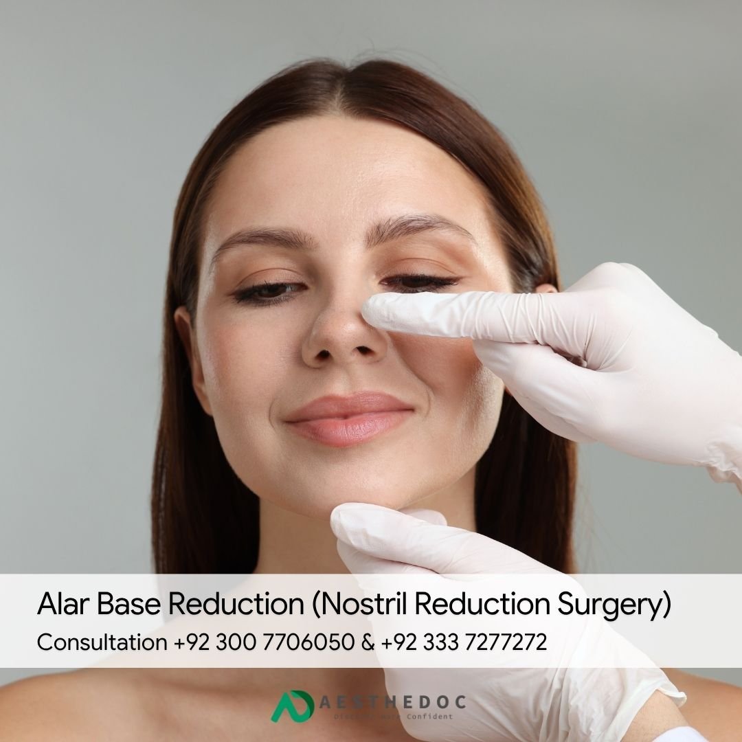 Alar Base Reduction (Nostril Reduction Surgery)
