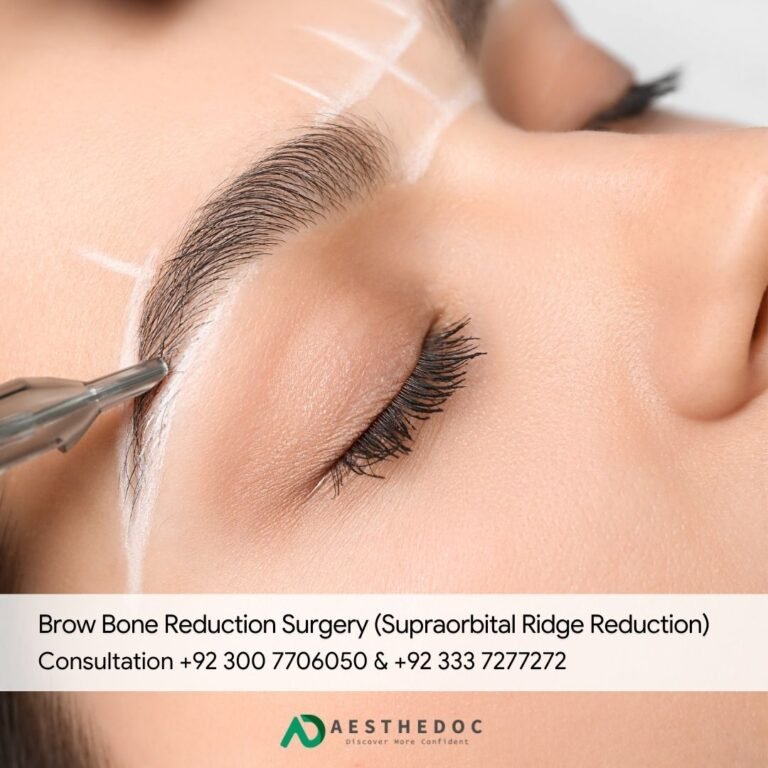 Brow Bone Reduction Surgery (Supraorbital Ridge Reduction)
