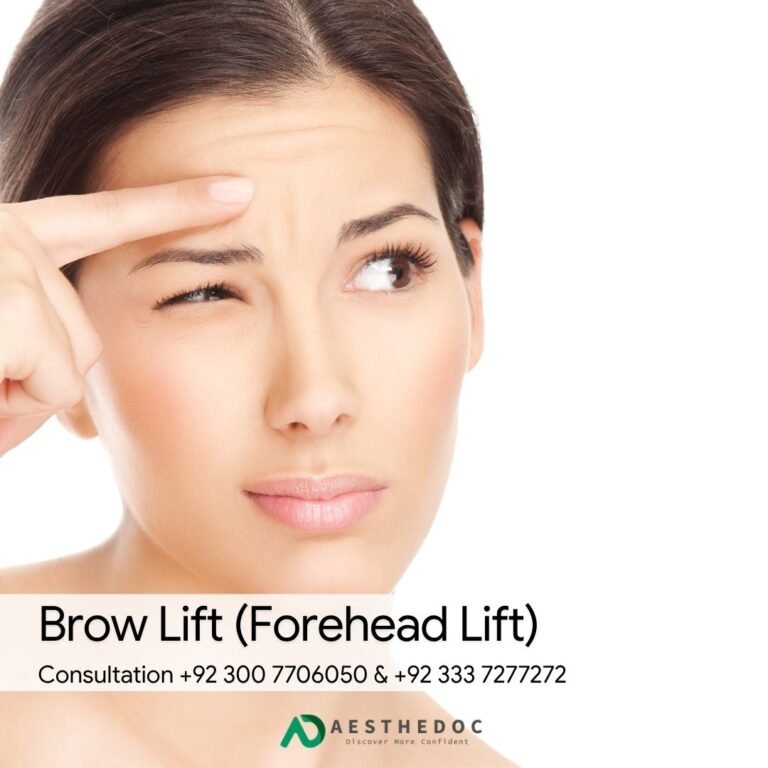 Brow Lift (Forehead Lift)