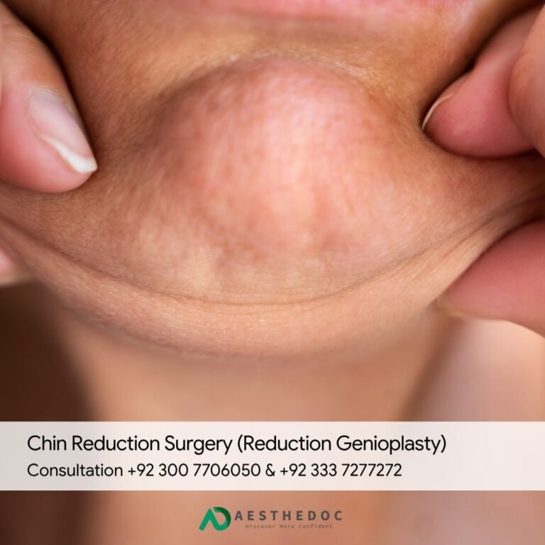 Chin Reduction Surgery (Reduction Genioplasty)