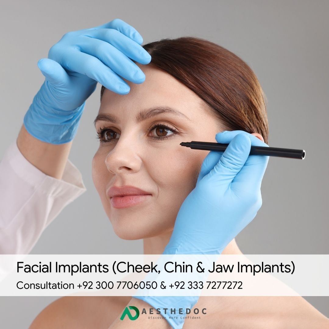 Facial Implants (Cheek, Chin & Jaw Implants)