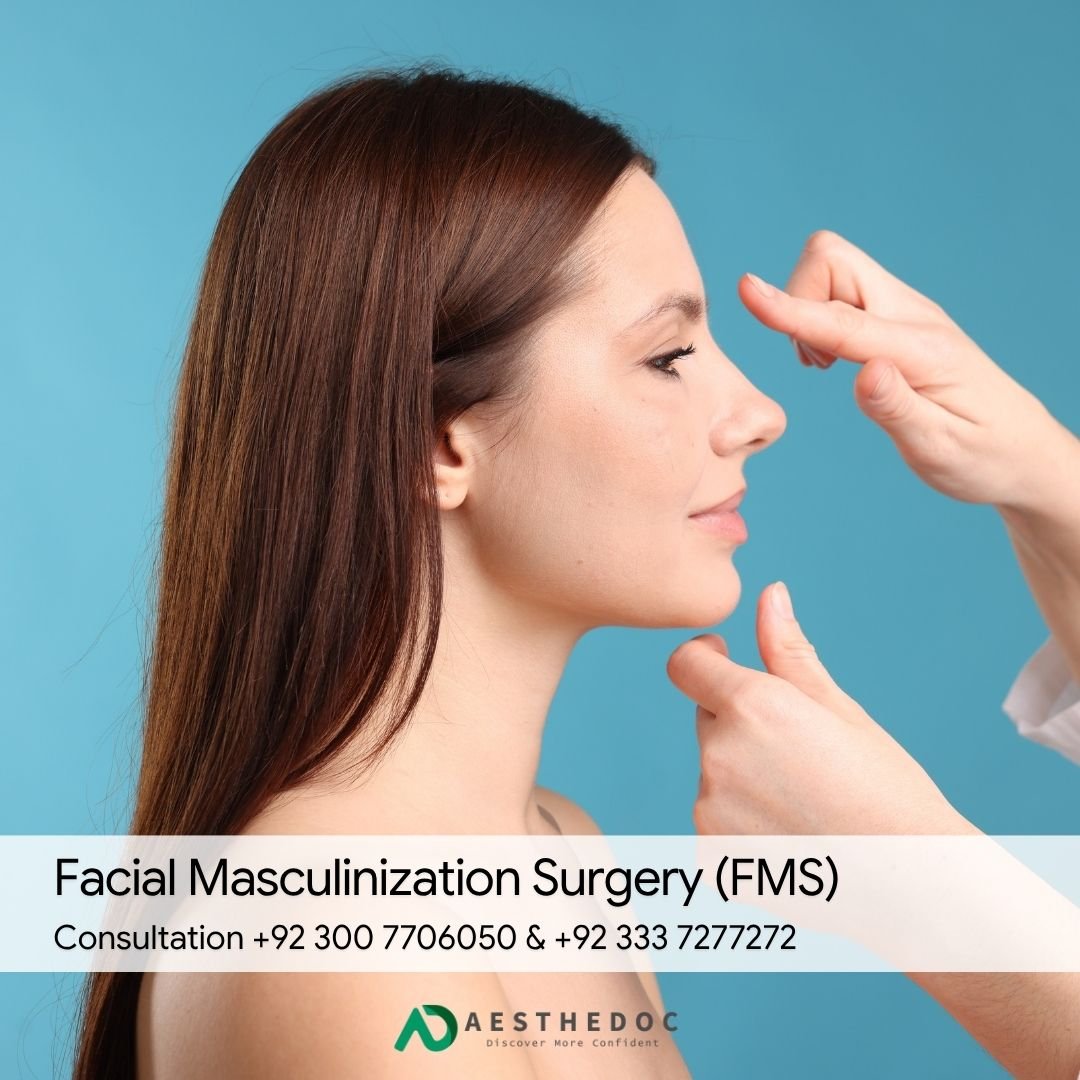 Facial Masculinization Surgery (FMS)
