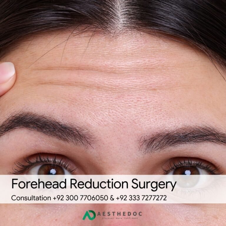 Forehead Reduction Surgery