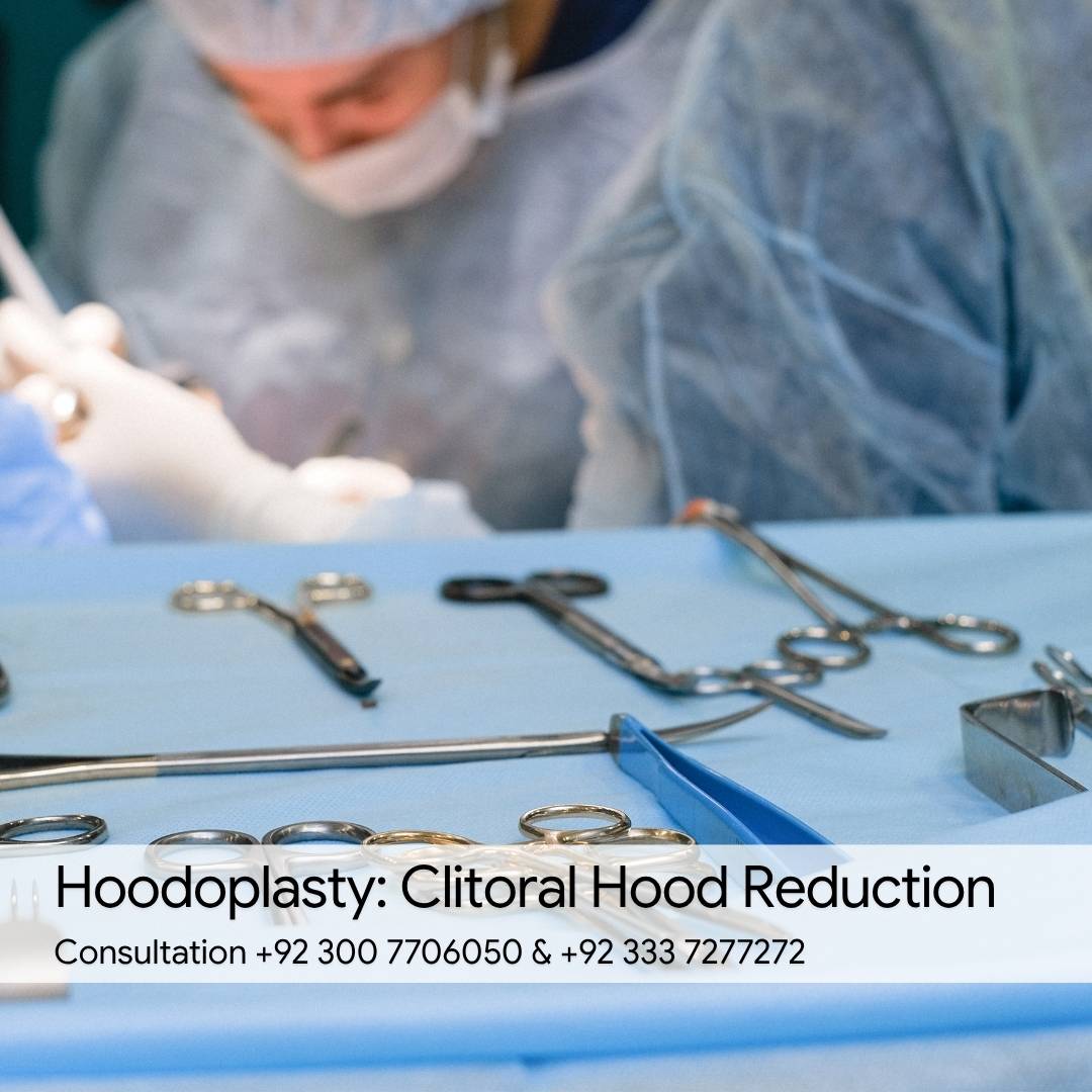 Hoodoplasty Clitoral Hood Reduction