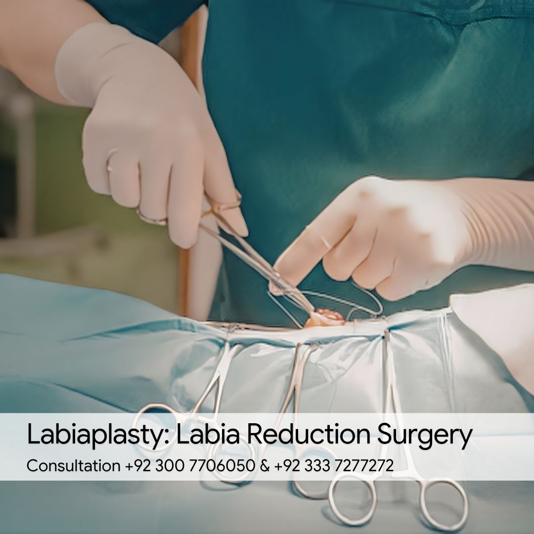 Labiaplasty Labia Reduction Surgery