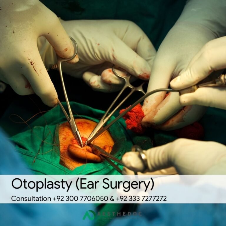 Otoplasty (Ear Surgery)