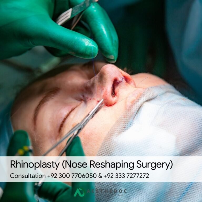 Rhinoplasty (Nose Reshaping Surgery)