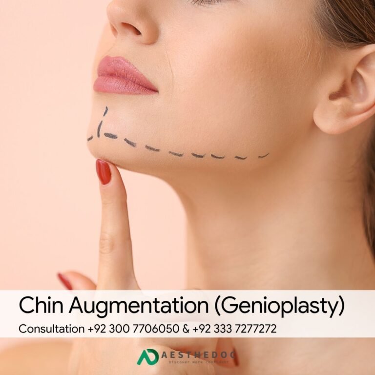 Chin Augmentation (Genioplasty)